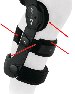 DonJoy® Legend™ CI Knee Brace Refurbishment Kit