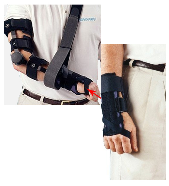 Aircast ARC Forearm Rotational Brace