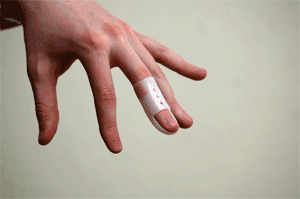 Mallet Finger Splints
