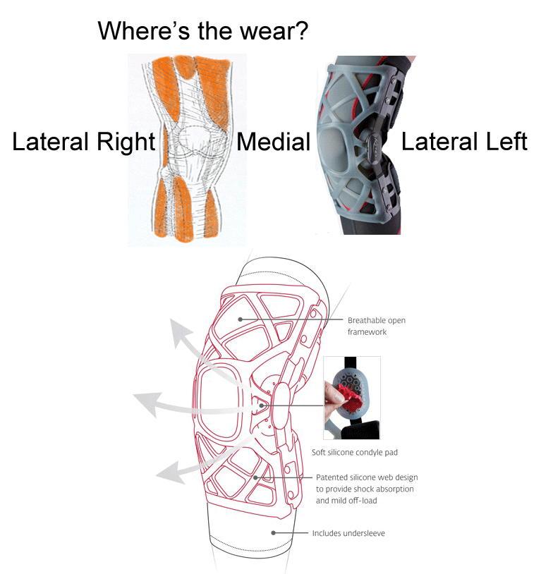 Donjoy OA REACTION WEB Patellofemoral Braces